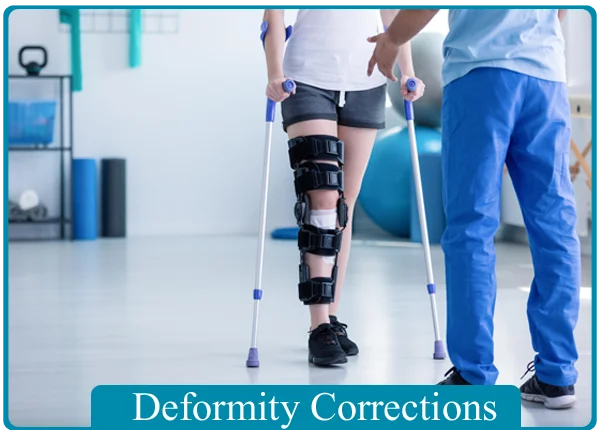 Deformity Corrections